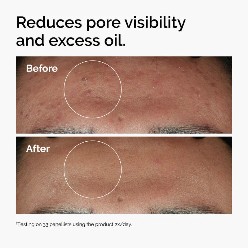 The Ordinary Niacinamide 10% & Zinc 1% Oil Control Serum - 60ml